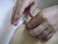 刺鍼3